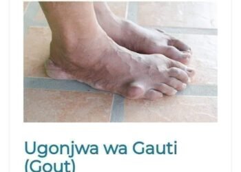 Ugonjwa wa Gauti, Dalili zake, Sababu na Tiba