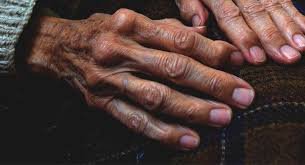 Dalili za Ugonjwa wa Baridi Yabisi, Sababu na Tiba