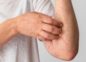 Fahamu Ugonjwa wa Beriberi, Sababu, Dalili Zake na Tiba