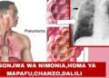 Dalili za Ugonjwa wa Nimonia, Sababu na Tiba