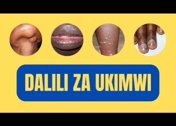 Dalili za Ugonjwa wa Ukimwi kwa Mwanaume, Sababu na Tiba