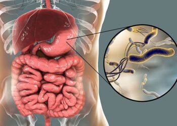 Fahamu ugonjwa wa H. pylori, Sababu, Dalili zake na Tiba