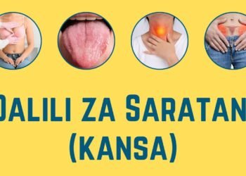 Zijue Dalili za Saratani (kansa), Sababu na Tiba