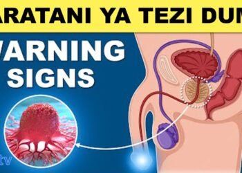Hizi ndio Dalili za Saratani ya Tezi Dume, Sababu na Tiba