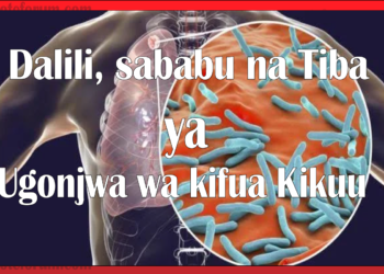 Dalili za ugonjwa wa Kifua Kikuu, Sababu na Tiba