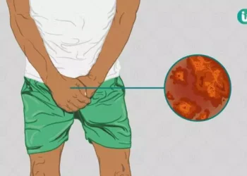 ugonjwa wa fangasi kwa wanaume